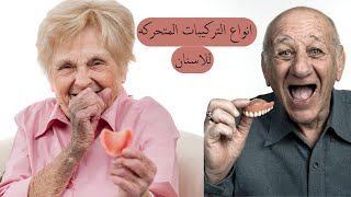 انواع التركيبات المتحركه للاسنان/تركيبات الاسنان/تركيبات الاسنان المتحركه