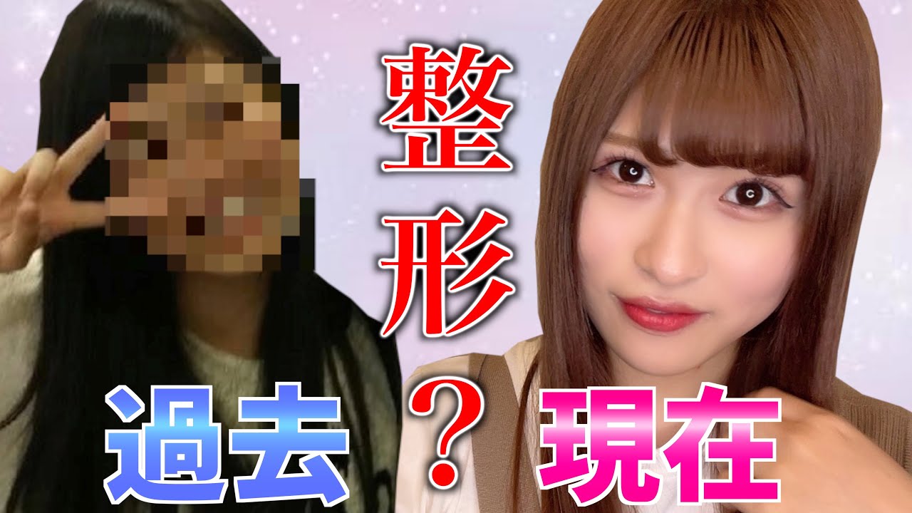 整形疑惑 部下の顔が過去と違いすぎる件 일본유튜버 우투
