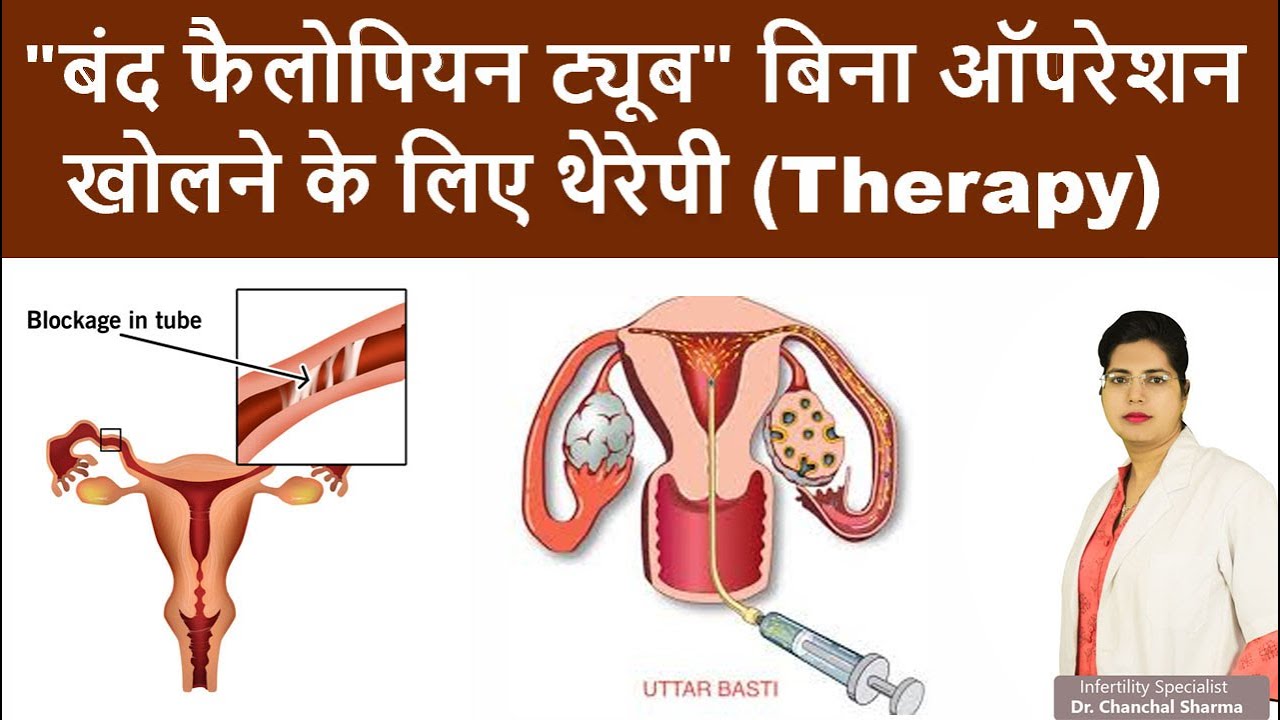 How To Open Fallopian Tube Naturally In Hindi Blocked Fallopian Tubes How To Open Fallopian Tube Naturally In Hindi Blocked Fallopian Tubes