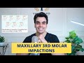 Maxillary third molar impactions