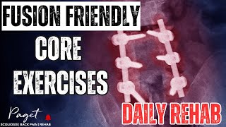 Core Exercises For People With Fused spine | Scoliosis and more