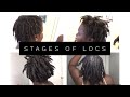 Stages of Locs | Thick 4C Locs