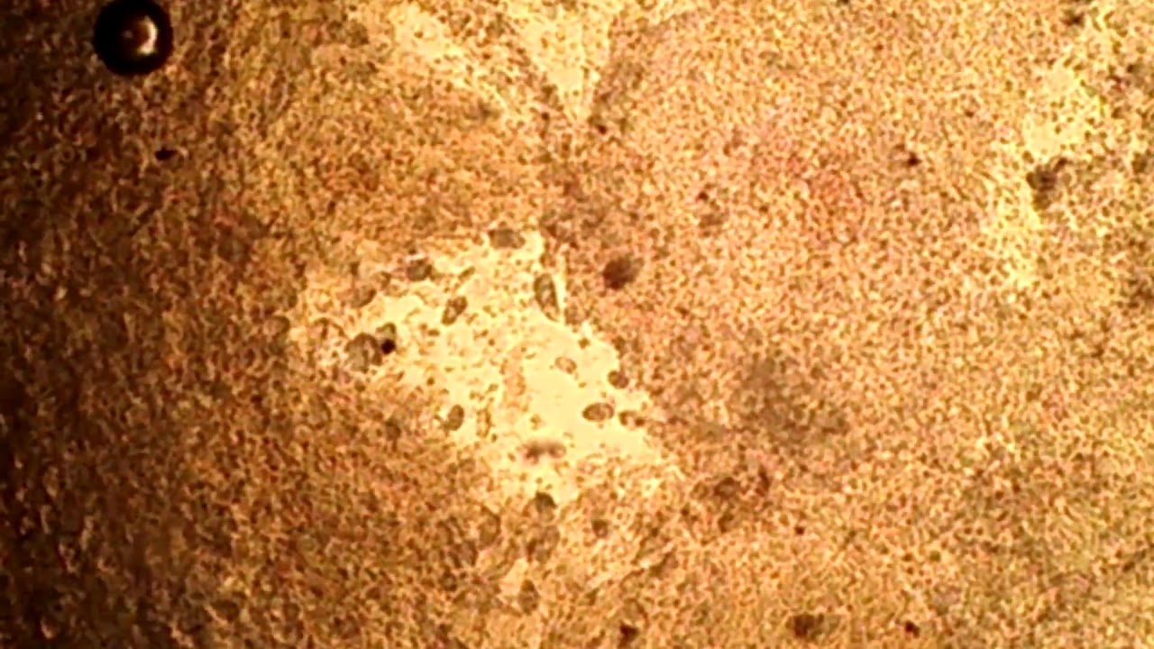 Fish Parasites  Under a Microscope YouTube