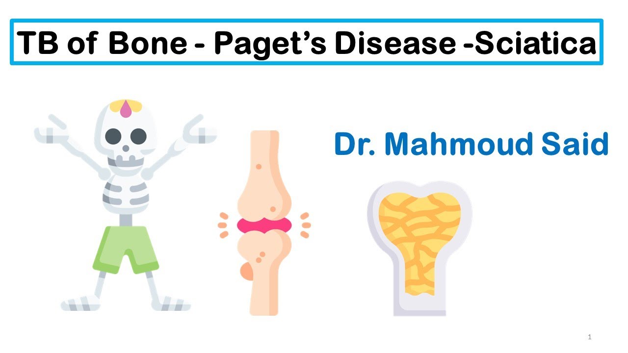 Bone Disorders-6- TB of Bone Paget’s Disease  Sciatica مرض باجيت السل العظمى  عرق  النسا