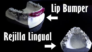 Elaboración de Lip Bumper y rejilla Lingual | Elena Dental Art & More