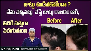 జుట్టు రాలుతోందా | Tips To Prevent Hair Fall In Telugu | Hair Loss Diet and Treatment | Dr Raj Kirit