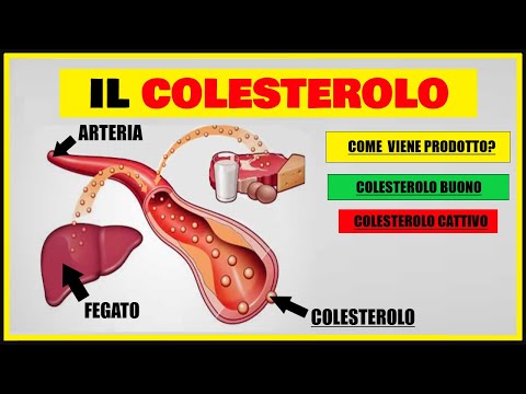 Video: Gli Effetti Del Colesterolo Sul Corpo