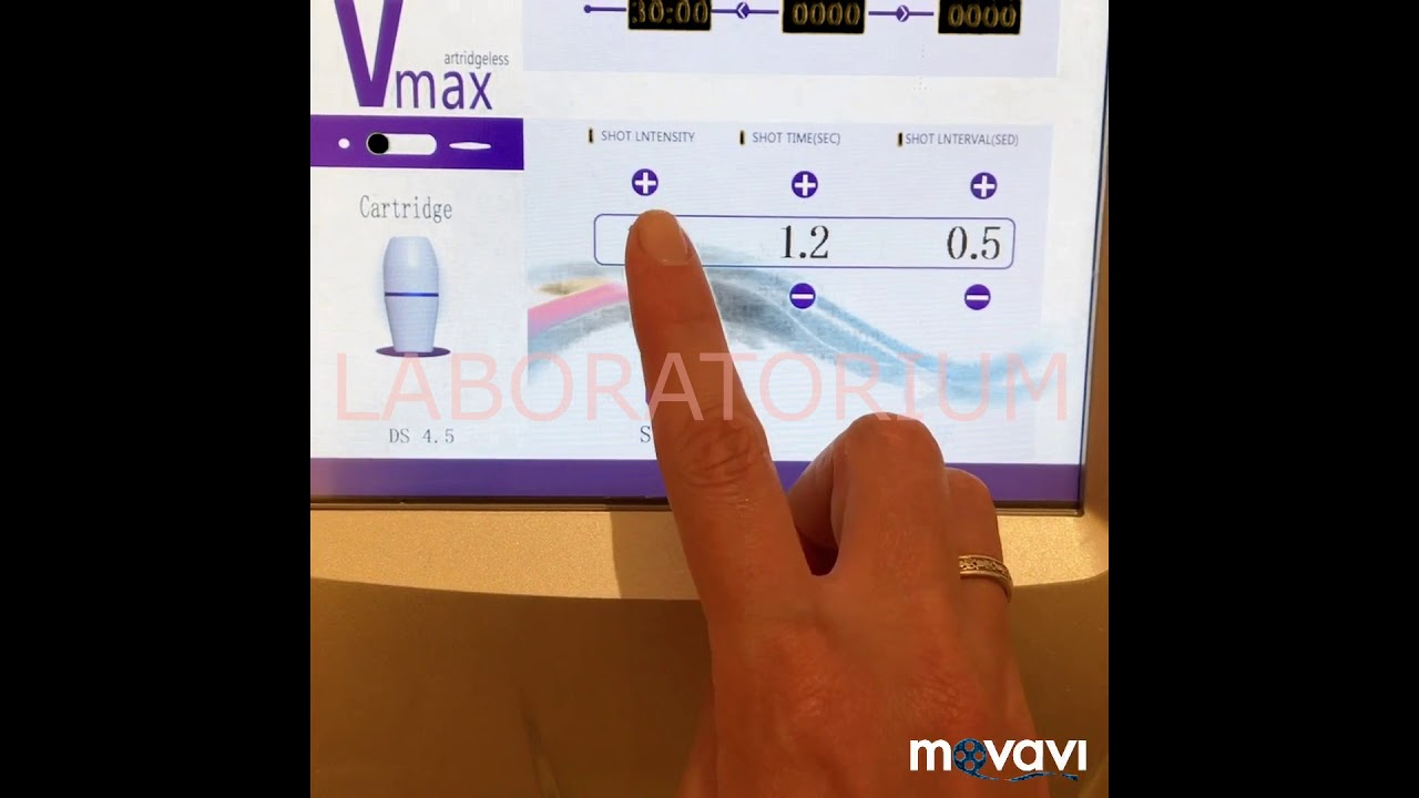 V-MAX HIFU плазма пен растяжки