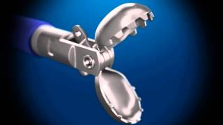 Sample Endoscopic Biopsy   3D animation   DG Medical Animations HD