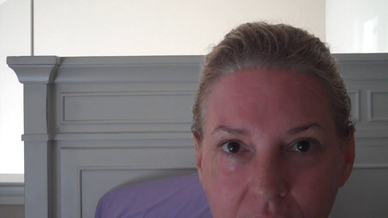 Sciton Contour TRL Laser Recovery Diary with & without Makeup in Dallas, Texas