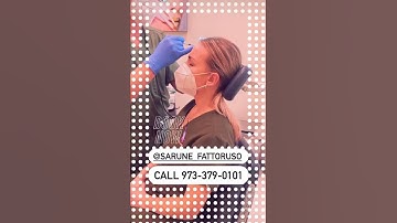 DYSPORT INJECTIONS (aka Botox) WITH DR. OVCHINSKY | QUICK & PAINLESS