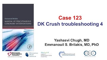 Case 123: PCI Manual - DK crush troubleshooting 4