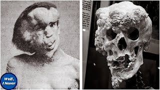 The Tragic Story of The 'Elephant man' Joseph Merrick | Well, I Never