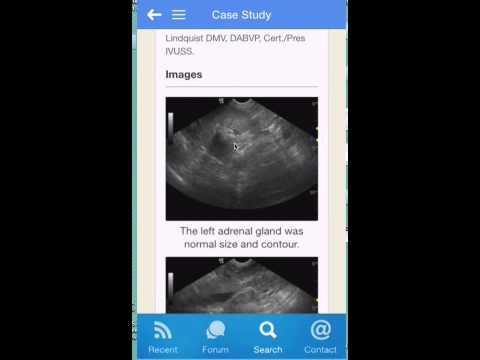 The SonoPath Mobile App Demo by Dr. Eric Lindquist