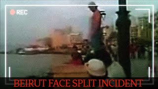 Face Split Guy 2009 Manara Promenade Unfall Fallyse