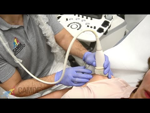 Sesión EPI Málaga (Electrolisis Percutánea Intratisular)  | Centro médico CAMDE