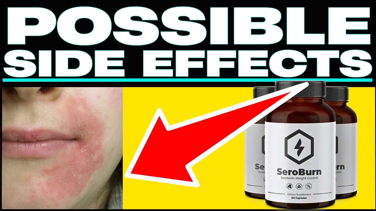 (😱❌BEWARE!⛔🙀) Get Your FREE Bottle Of SeroBurn???