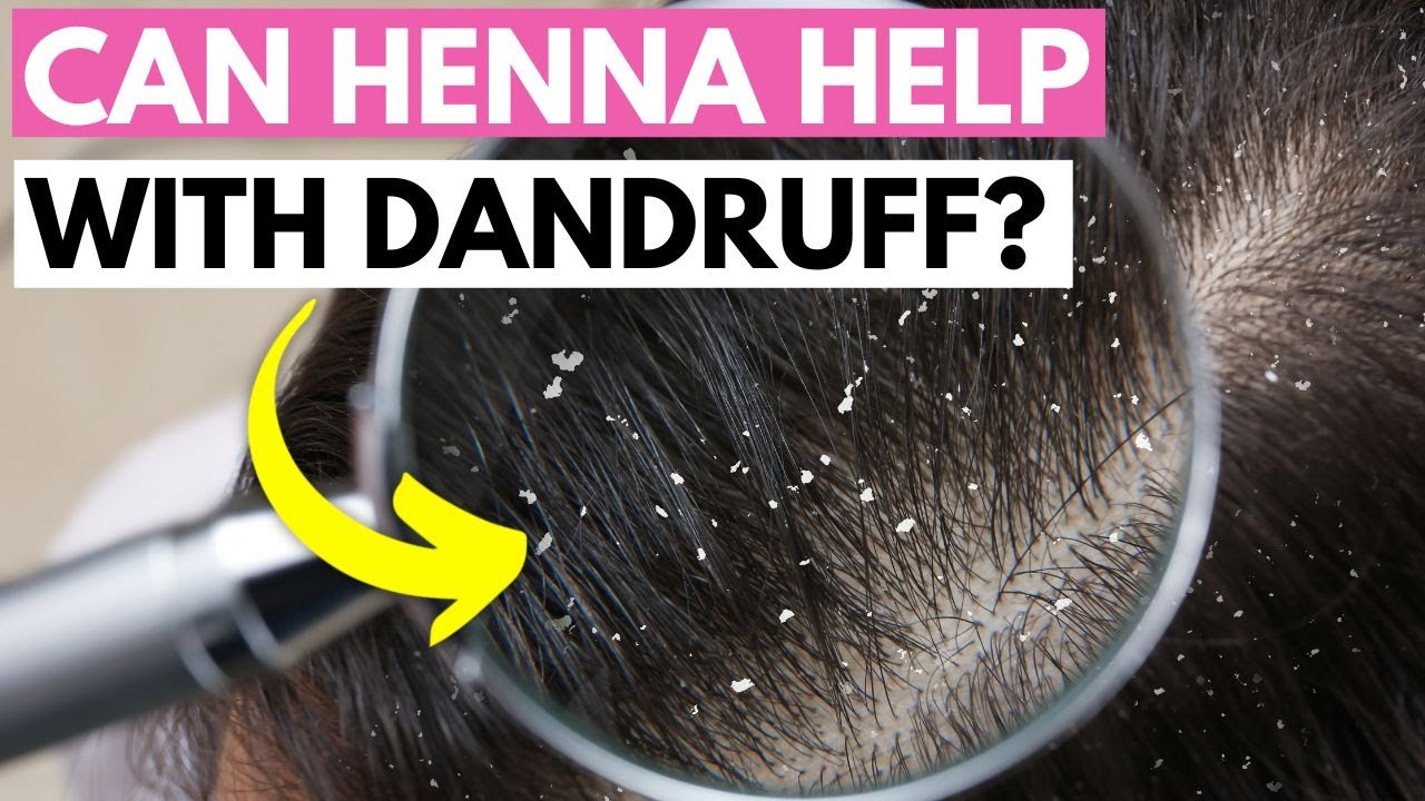 Does Henna Help with Dandruff? Henna Expert Answers Your Haircare