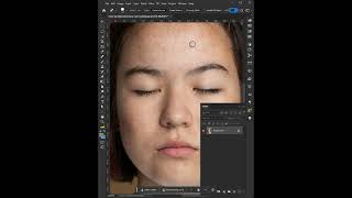 How to remove acne from the face using  Photoshop