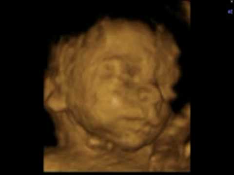 3d/4d ultrasound baby boy week 25+1 - YouTube