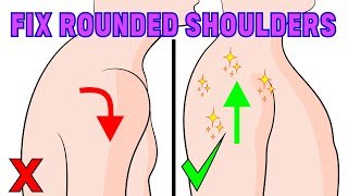 The 4 minute solution to fix rounded shoulders