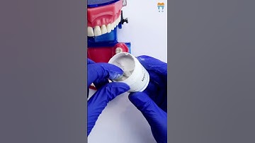 Waldent DenTemp Temporary Filling Material