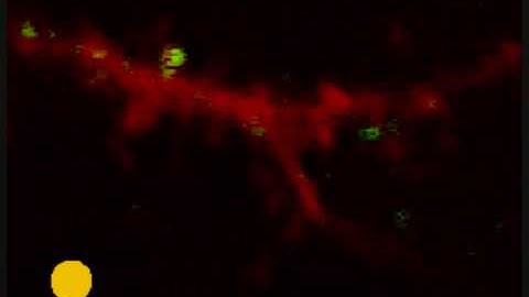 Dendritic spine activity in the auditory cortex