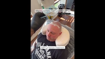 SMP Correction Treatment #scalpmicropigmentation #smp #smptraining