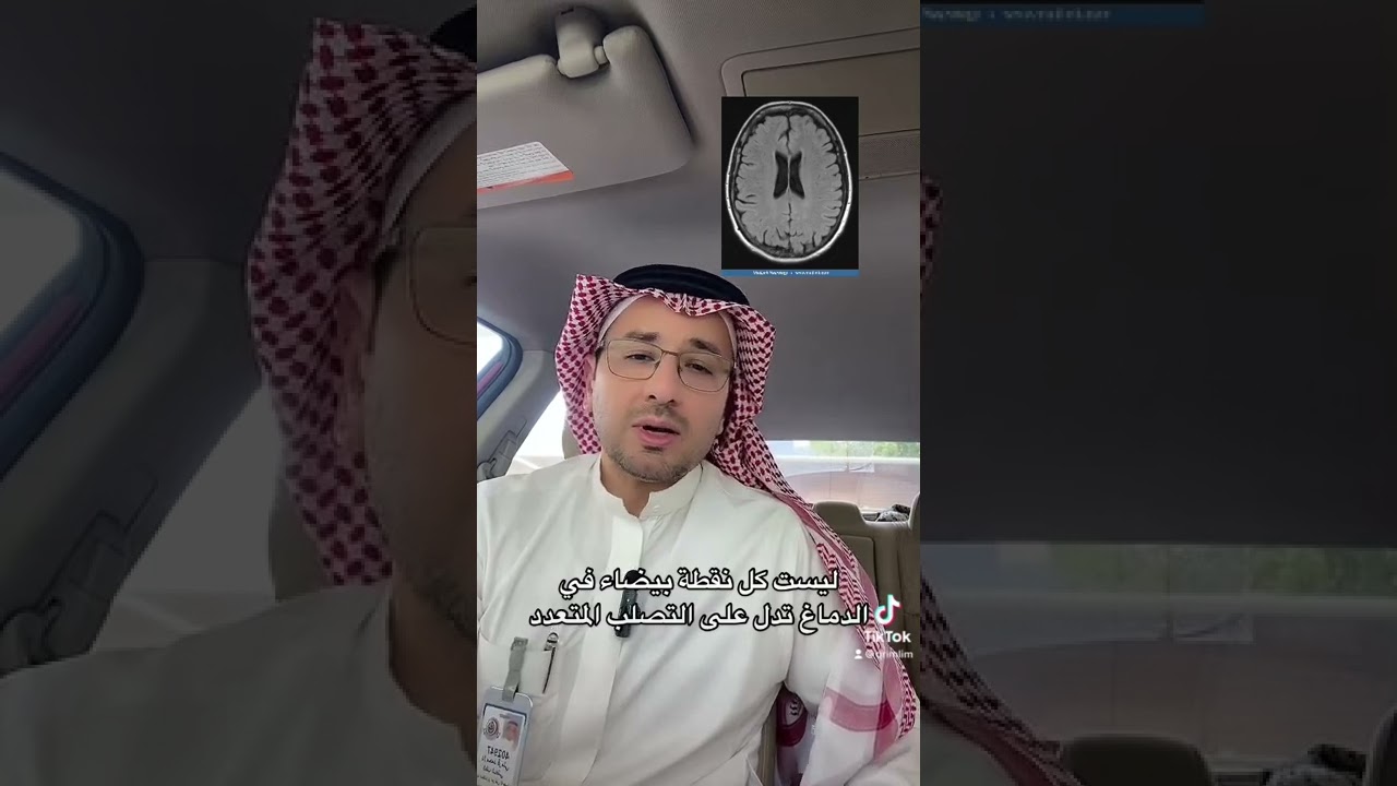 النقط البيضاء في الرنين المغناطيسي للدماغ