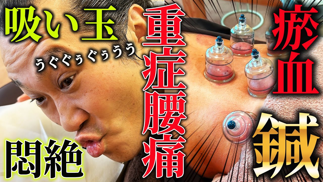 Sapporo Teine Ward Chiropractic] The King of Suction Cups in Agony