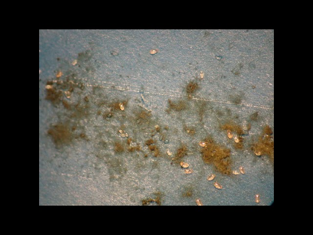 Mold Mites In Bathroom Fleas, Springtails, And Fungus Gnats: What