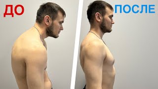 ТОП 3 упражнения при КИФОЗЕ / СУТУЛОСТИ
