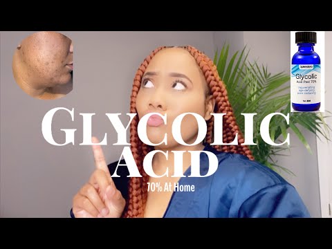 Video: Peel Acid Glycolic Acid Untuk Bekas Jerawat, Stretch Marks, Hyperpigmentation