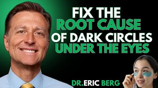 Fix the Root Cause of Dark : Circles Under the Eyes|Dr Eric Berg  Fix The Root Cause Of Dark Circles Under The Eyes
