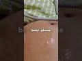 胎児超音波心音計 Baby Phone ベビーフォン Fetal Ultrasound Heart Rate Monitor Baby Phone#baby #amazing #japan