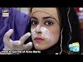 Watch How to Get Rid of Acne Marks Online In Hd