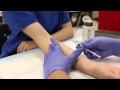How To Do an Intradermal Injection