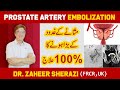 Prostatic Artery Embolization | Enlarged Prostate | Masana ki gadood ka ilaj