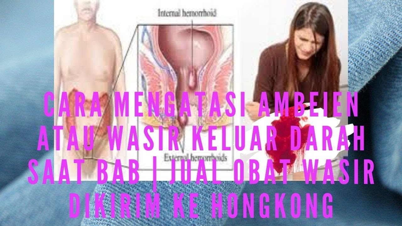 Cara Mengatasi Ambeien Atau Wasir Keluar Darah Saat Bab | jual obat