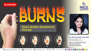 Burns Injury - Types, Degree, Symptoms and First Aid | Managements of Burns Injuries