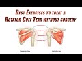 Best Self-Treatment of a Rotator Cuff Tear | Shoulder Rehab without Surgery