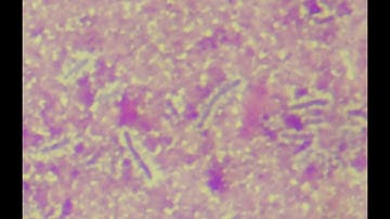 BACTERIAL CAPSULES & SLIME LAYERS