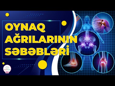 Video: Neçə kostoxondral oynaq var?