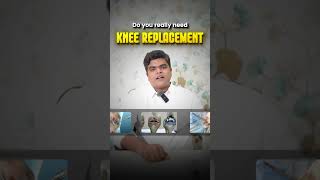 🦵 Do you REALLY need a Knee Replacement?