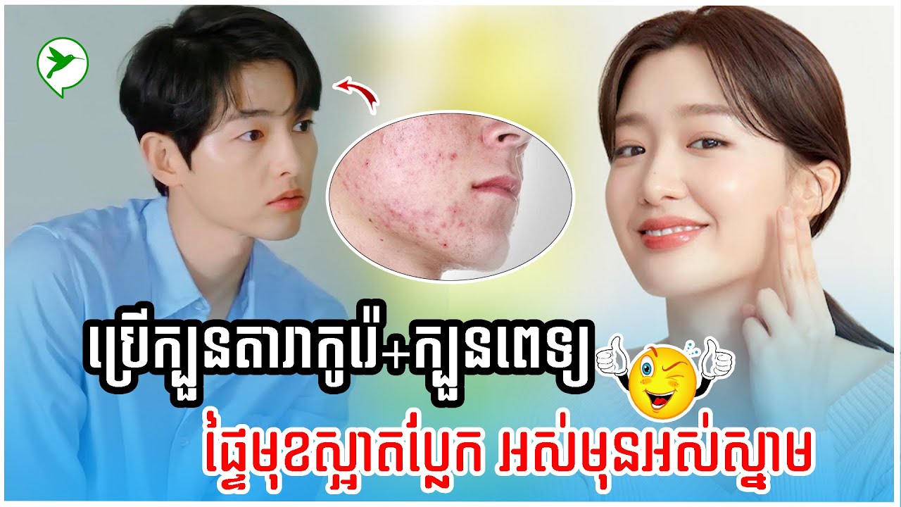 ទម្លាប់ថែមុខប្លែកៗចម្លែកអារម្មណ៍ ងាយៗតែធ្វើឱ្យមុខគ្មានមុនសូម្បីតែ១គ្រាប់/Be Healthy