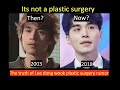 Why Lee dong wook plastic surgery rumour is not true | past pictures #kdramas
