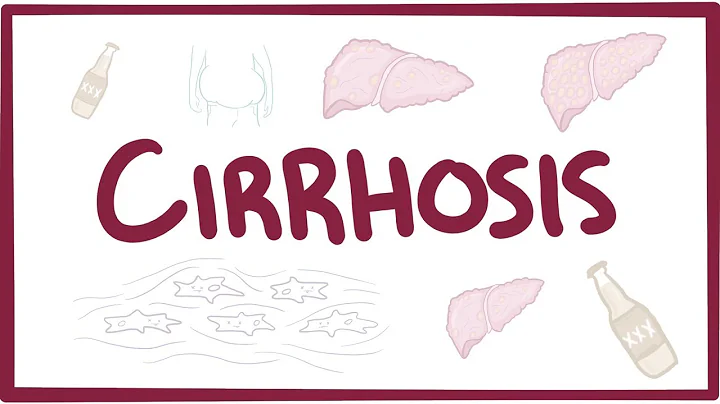 Cirrhosis - causes, symptoms, diagnosis, treatment, pathology - DayDayNews