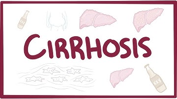 Sirosis - penyebab, gejala, diagnosis, pengobatan, patologi