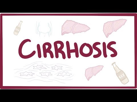 Video: Gdje utječe ciroza?