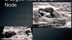 12 Breast Ultrasound